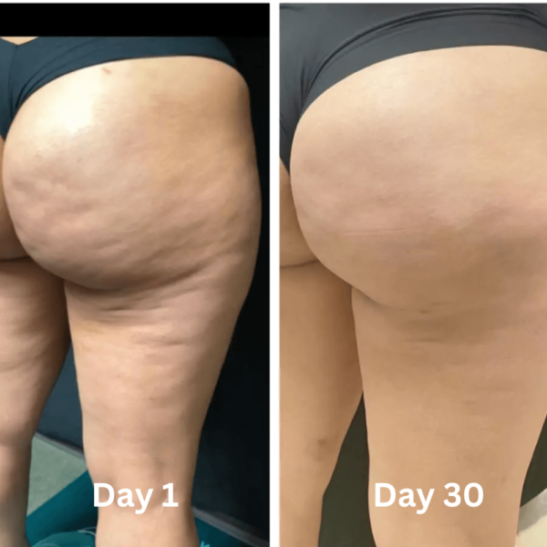 Cellu-Glow | Anti Cellulite Oil - Image 4