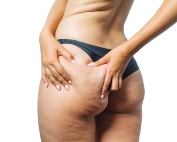 Cellu-Glow | Anti Cellulite Oil - Image 5